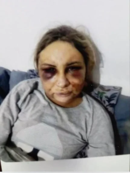 У Чернівцях 18-річного хлопця підозрюють у жорстокому побитті дівчини — Вікторія в глибокій комі
