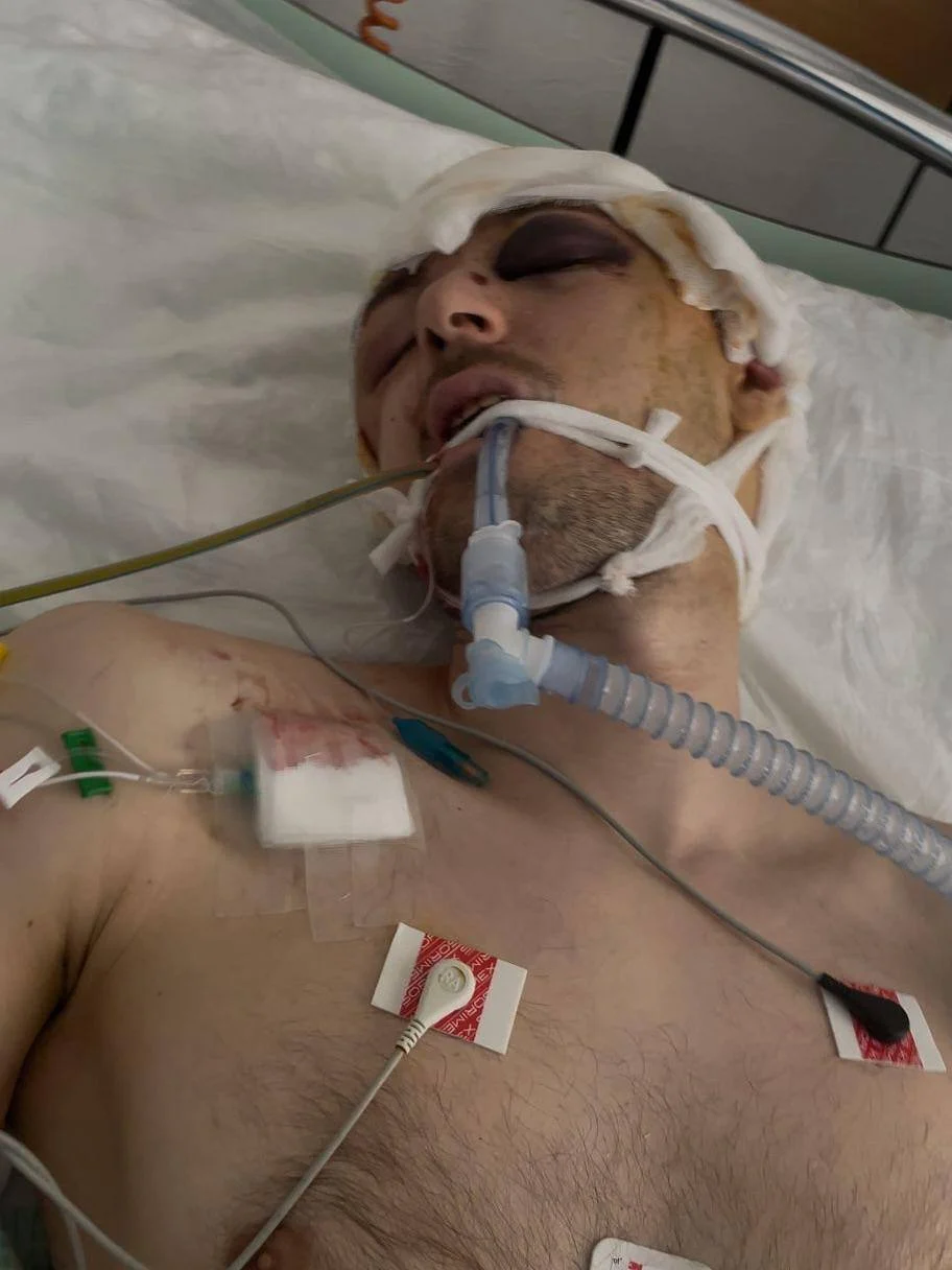 У Луцьку після затримання ТЦК чоловік опинився в реанімації з важкою черепно-мозковою травмою